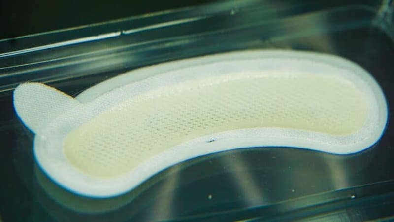 Detachable and Dissolvable Microneedle