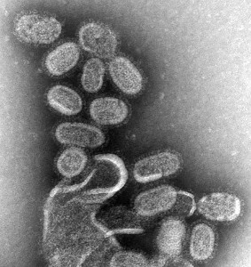CDC researchers re-created the 1918 influenza virus in 2005