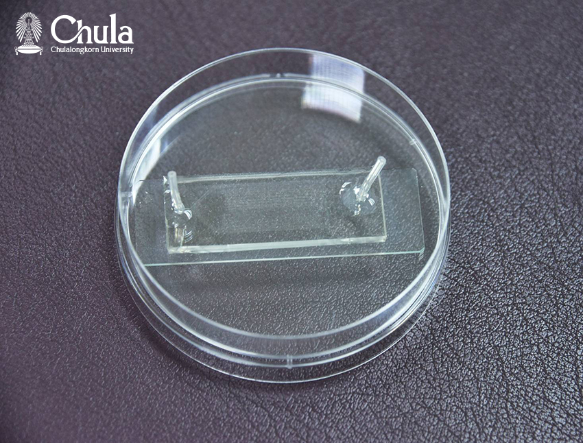 The microfluidic chip device
