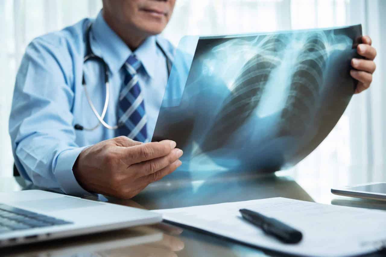 Doctor observing a chest X-ray radiograph.