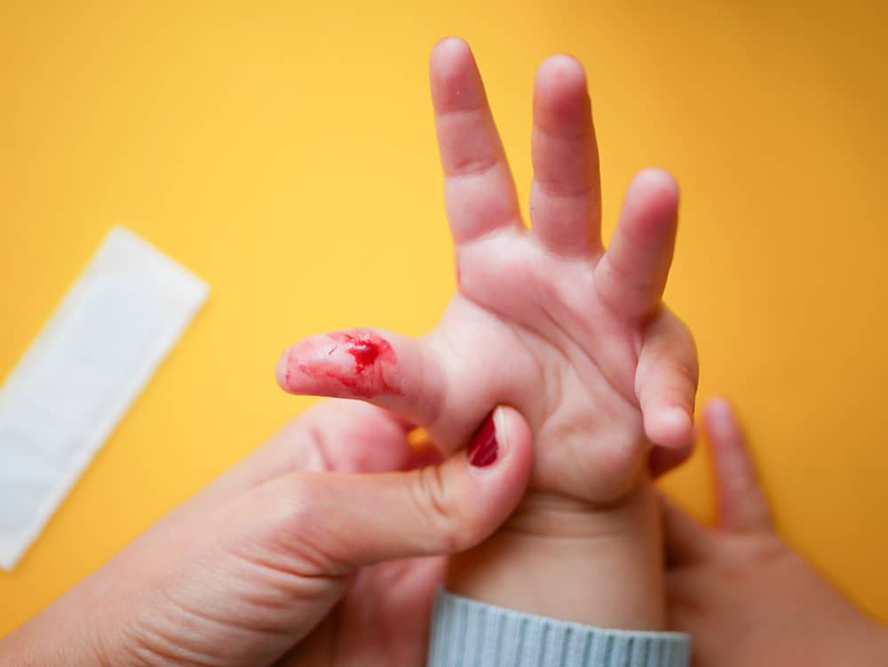 Child with cut finger injury